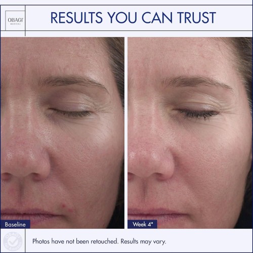 أوباجي-360 ريتينول 1% | 28 جم أوباجي-360 ريتينول 1% | 28 جم